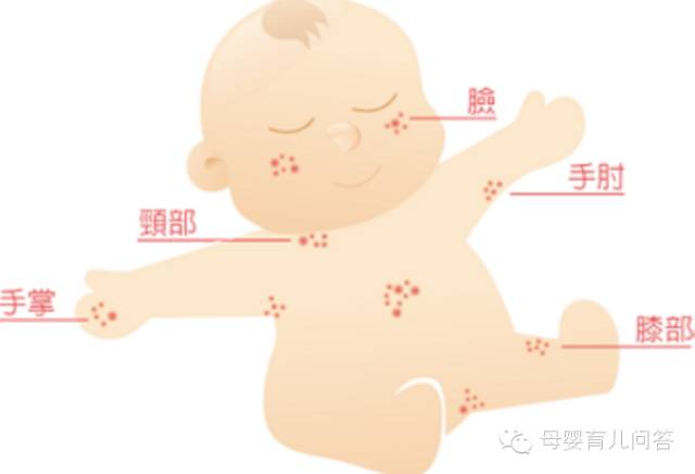 宝宝吃锌硒宝起疹子(锌硒片宝宝能吃吗)-硒宝网