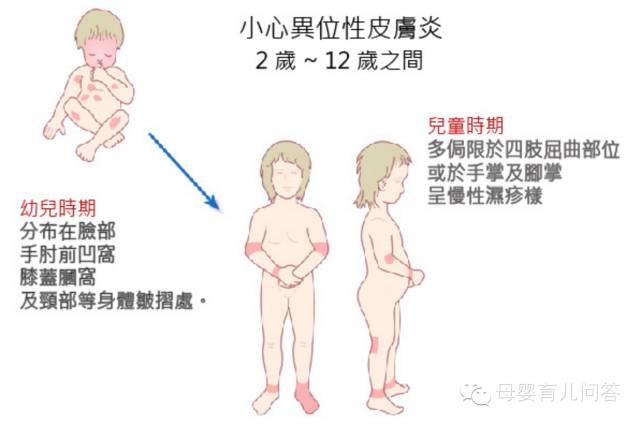 宝宝吃锌硒宝起疹子(锌硒片宝宝能吃吗)-硒宝网