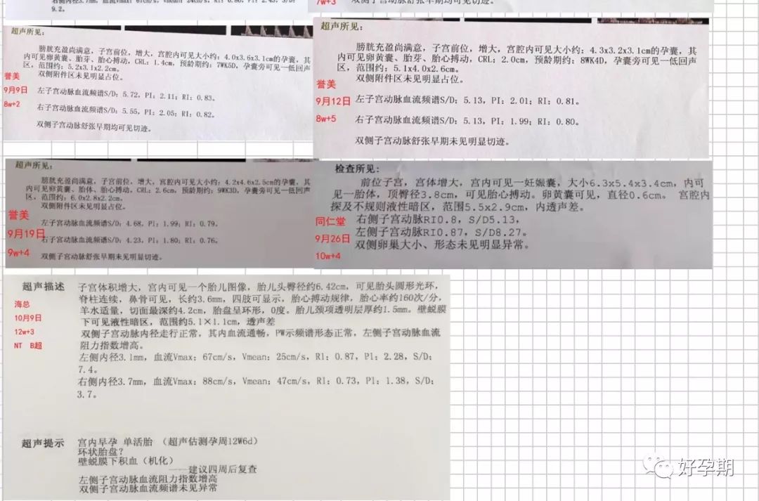月子可以吃锌硒宝吗(锌硒宝宝宝吃了有什么效果)-硒宝网