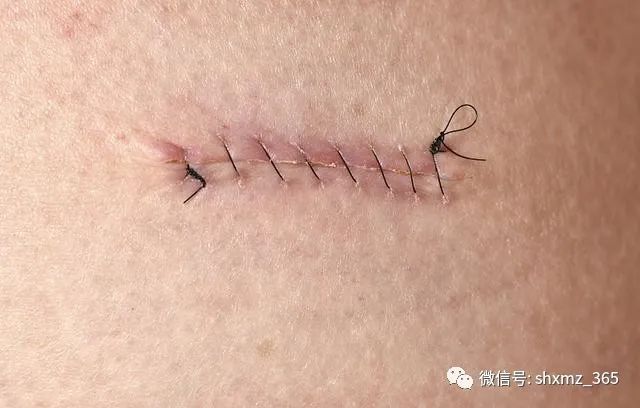 补锌吃什么(吃补锌的药有副作用吗)-硒宝网