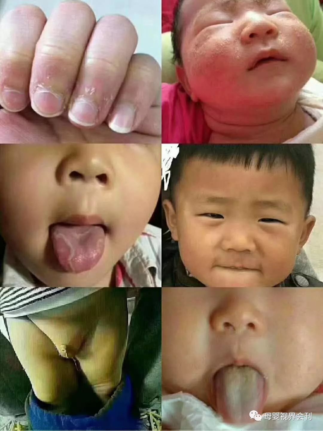 成人补锌（成人补锌吃什么药）-硒宝网