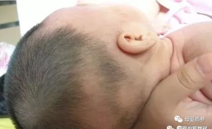 3个月的宝宝需要补钙吗(补钙宝宝需要月子吃吗)-硒宝网