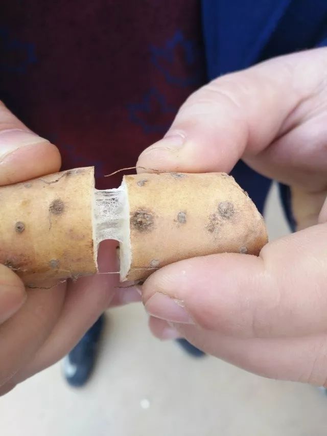 哺乳期缺锌吃锌硒宝（哺乳期补锌）-硒宝网