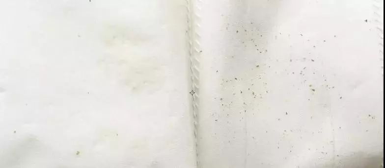 儿童吃什么补铁效果最好（小孩子补铁的）-硒宝网