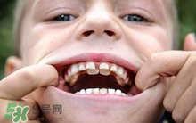 儿童换牙补钙吃哪个好(儿童换牙期间补钙)-硒宝网