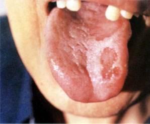 锌硒宝片每次吃几片(锌硒宝片可以吞服吗)-硒宝网