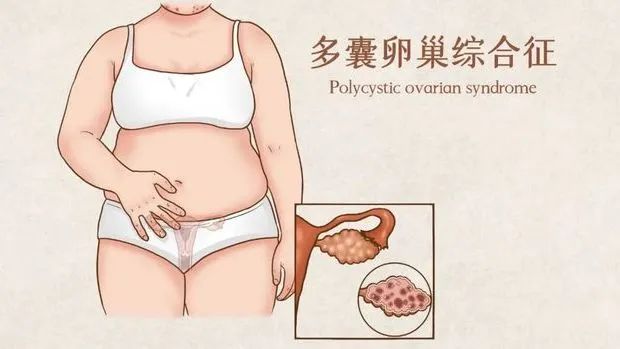 不备孕可以吃锌硒宝（女人备孕吃锌硒宝的功效）-硒宝网