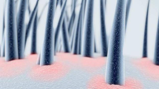 锌硒宝可以治湿疹吗（锌对湿疹的作用）-硒宝网