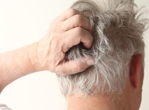 锌硒宝可以治湿疹吗（锌对湿疹的作用）-硒宝网