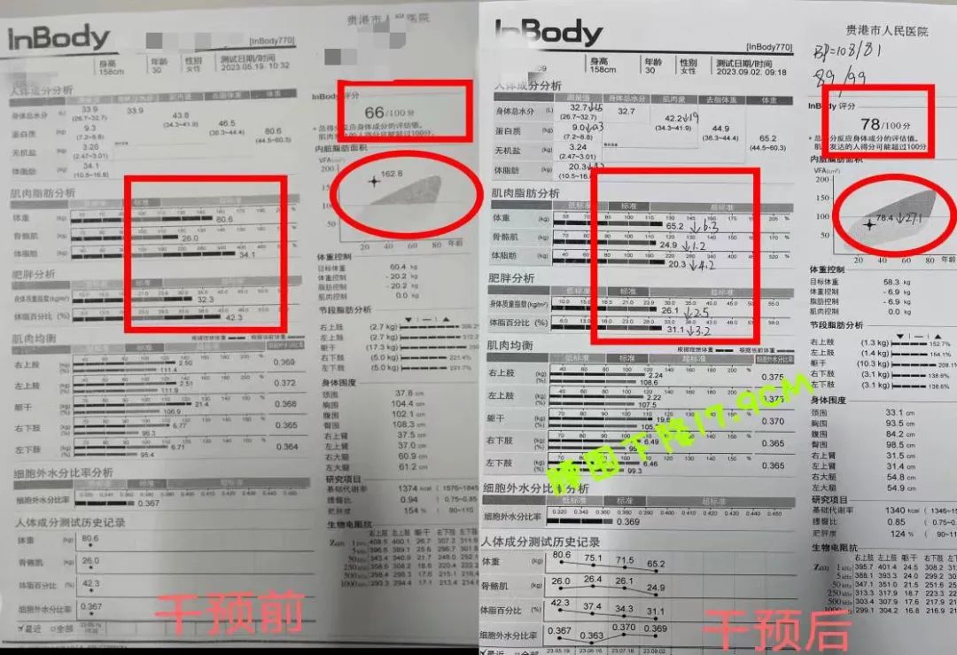 痛风可以吃锌硒宝吗（痛风可以吃硒的保健品）-硒宝网