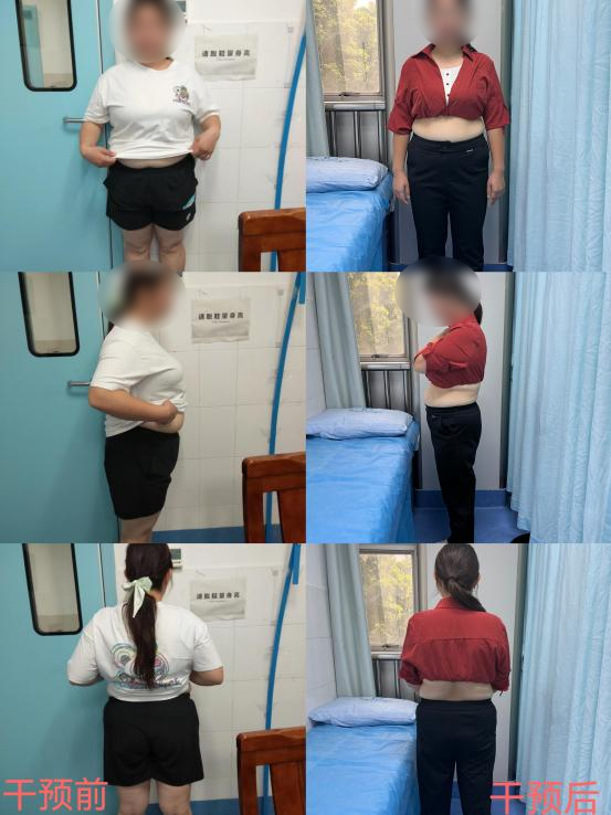 痛风可以吃锌硒宝吗（痛风可以吃硒的保健品）-硒宝网