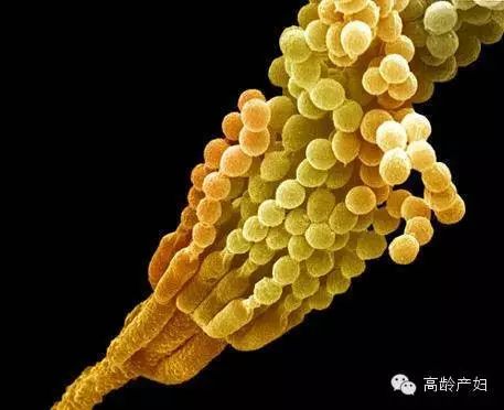 孕妇可以吃补铁的药吗（孕妇吃补铁的药还能吃钙片吗）-硒宝网