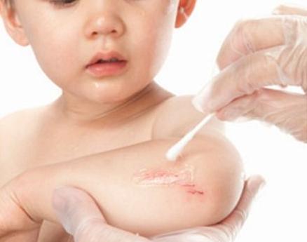 锌硒宝对儿童的作用（儿童锌硒宝）-硒宝网