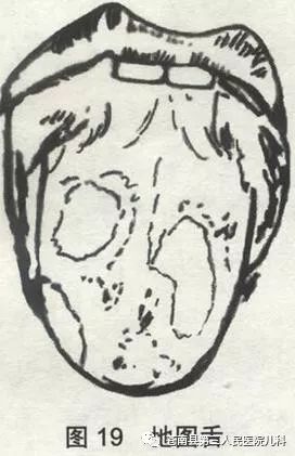 吃锌硒宝过敏性腹泻(锌硒宝拉肚子)-硒宝网