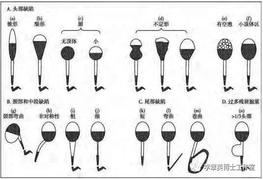 维生素e锌硒宝精子(锌硒宝和维生素e)-硒宝网