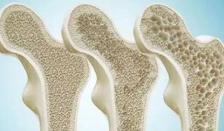 打补钙针好不好（打补钙的针多少钱一针）-硒宝网