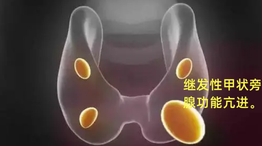 打补钙针好不好（打补钙的针多少钱一针）-硒宝网