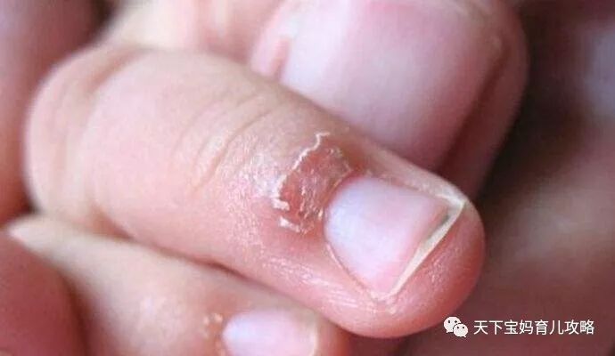 缺锌吃什么食物能补锌（缺锌吃的食物）-硒宝网