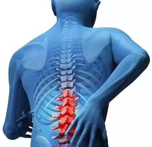 腰间盘突出要补钙吗（腰间盘突出补钙能起到作用吗）-硒宝网