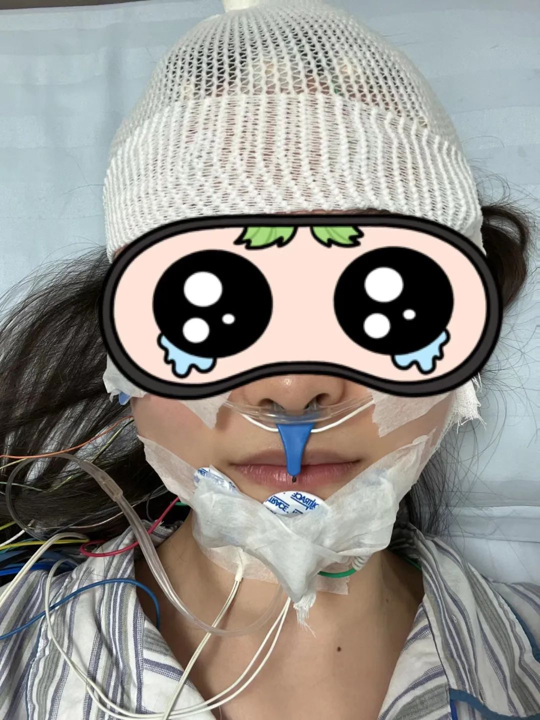 鱼补铁吗(鱼补铁补血吗)-硒宝网