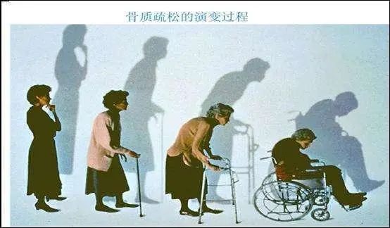 中年男性补钙吃什么钙片好（中年男人补钙）-硒宝网