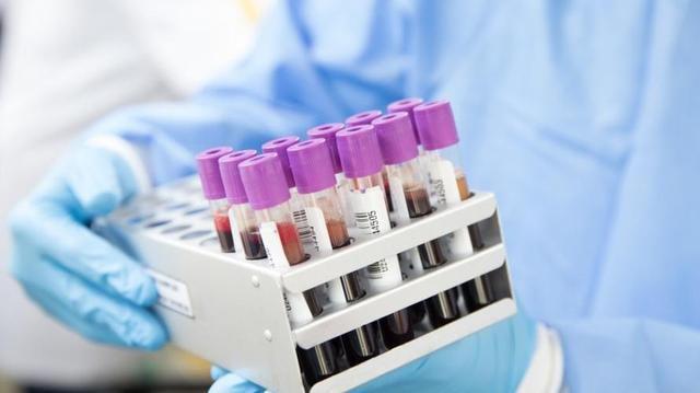 老人吃什么钙片补钙效果最好（老年人吃钙片好）-硒宝网