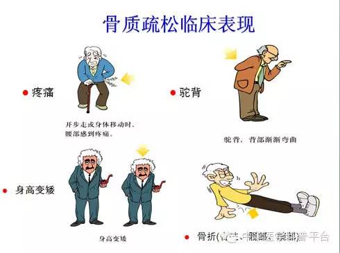 补钙补多了会怎么样(补钙会补过吗)-硒宝网