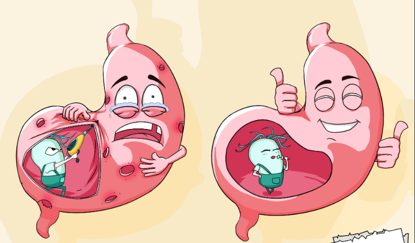胃癌的病人能补硒吗吗(胃癌可以吃硒吗)-硒宝网
