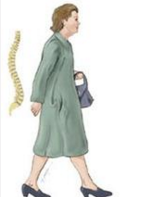 哪个季节补钙效果最好(这个季节补钙)-硒宝网