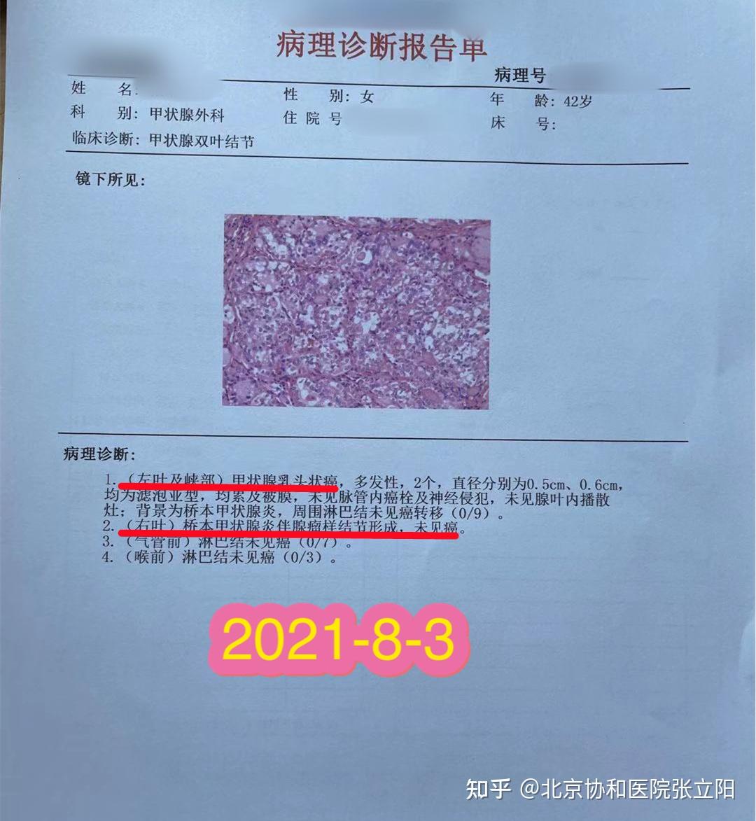 桥本氏甲状腺炎补硒量(桥本甲状腺炎硒)-硒宝网