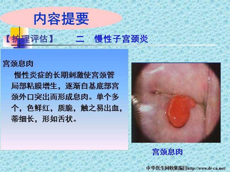 慢性宫颈炎需要补硒吗(慢性宫颈炎需要口服药物吗)-硒宝网