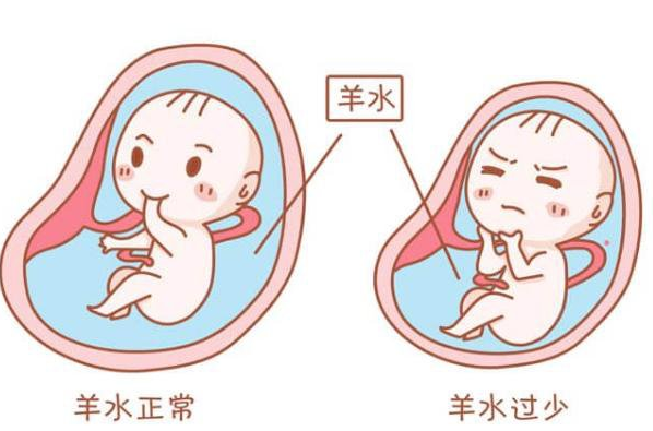 孕妇羊水少补硒有用吗（孕期补羊水）-硒宝网