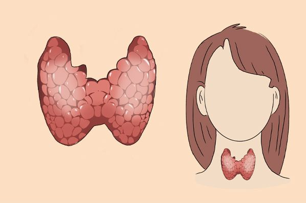 为什么甲状腺炎要补硒（甲状腺吃补硒的药）-硒宝网