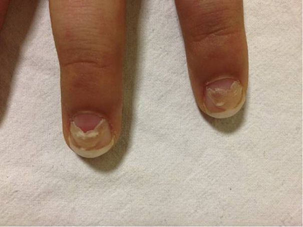 补硒能提高化疗效果吗(化疗时补硒可以减轻副作用吗)-硒宝网