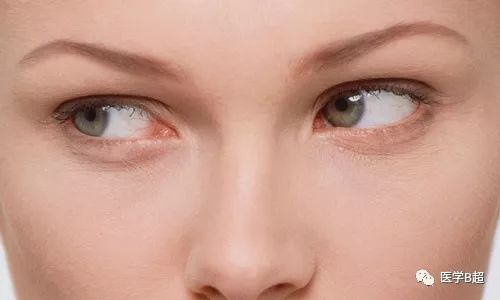 补硒有利于治疗痛风吗（痛风的患者补硒效果明显吗）-硒宝网