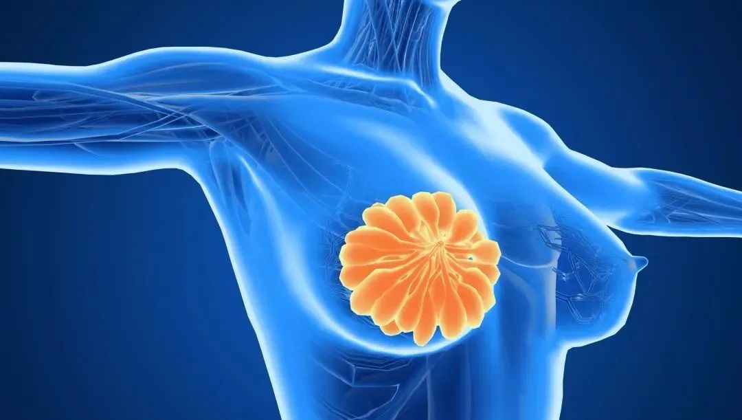 卵巢癌患者可以补硒吗（得了癌症吃硒还有用吗web）-硒宝网