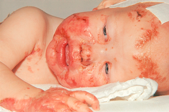 小孩查微量元素需要空腹吗(儿童化验微量元素早上空腹吗)-硒宝网