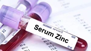 小孩查微量元素需要空腹吗(儿童化验微量元素早上空腹吗)-硒宝网