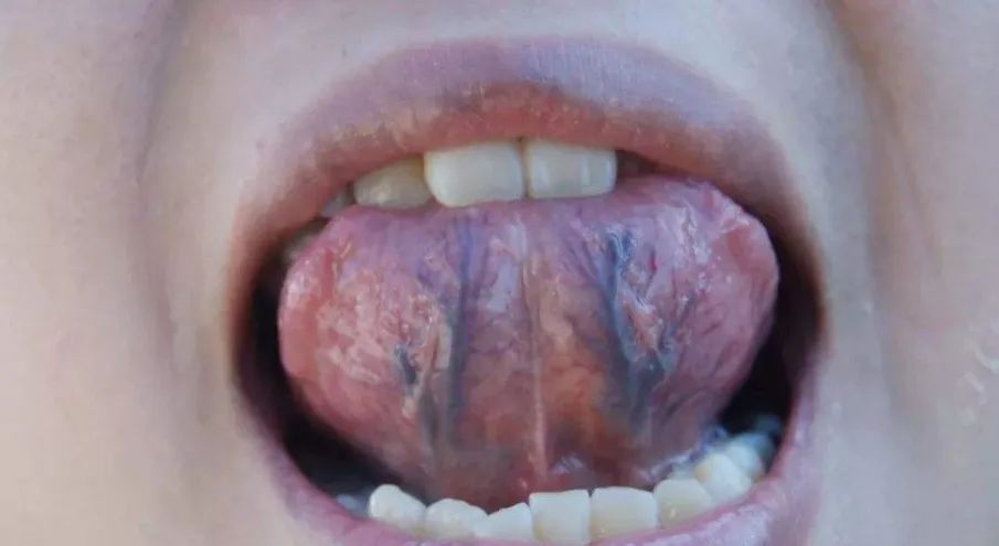 高血压补硒药店有卖吗(血压药店补卖高硒有什么好处)-硒宝网