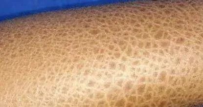 高血压补硒药店有卖吗(血压药店补卖高硒有什么好处)-硒宝网