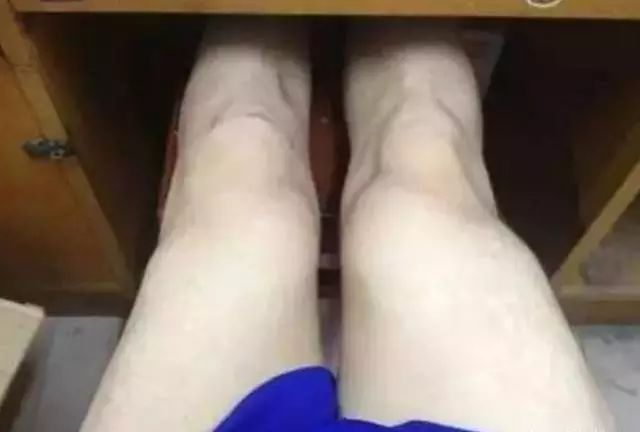 国珍哪款产品可以补硒（国珍硒片有什么作用）-硒宝网