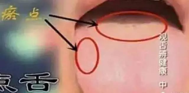 国珍哪款产品可以补硒（国珍硒片有什么作用）-硒宝网