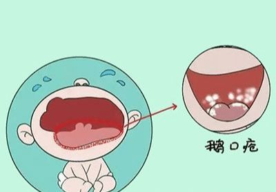 五个月宝宝需要补钙吗（宝宝补钙要补到几个月）-硒宝网