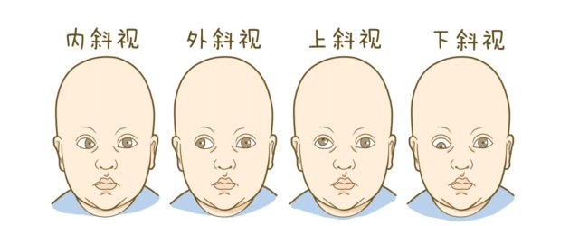 五个月宝宝需要补钙吗（宝宝补钙要补到几个月）-硒宝网