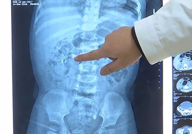 四个月宝宝可以补钙吗(补钙宝宝可以月经期吃吗)-硒宝网