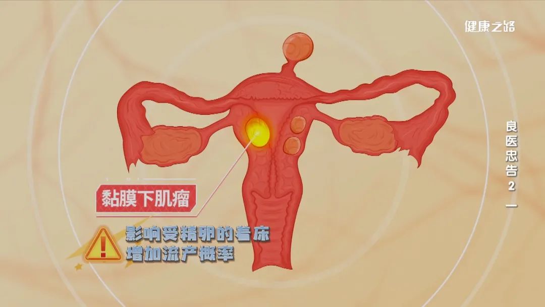 子宫内膜癌需要补硒吗（子宫内膜癌补充治疗）-硒宝网