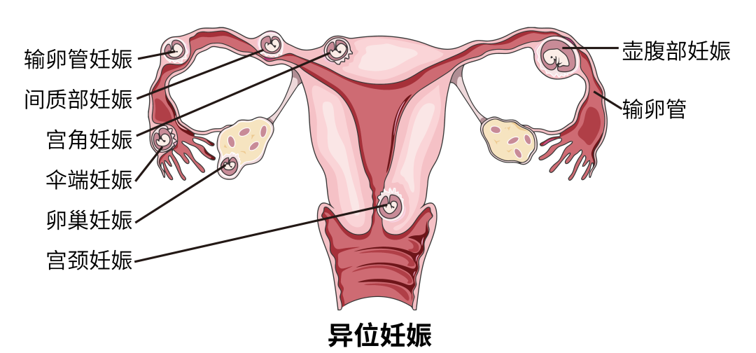 怀孕可以吃补硒的药吗（怀孕吃硒片）-硒宝网