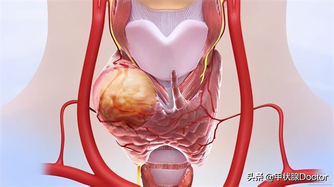 补硒能降低甲胎蛋白吗(甲减补蛋白质)-硒宝网