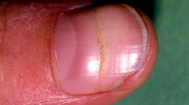 补硒能降低甲胎蛋白吗(甲减补蛋白质)-硒宝网