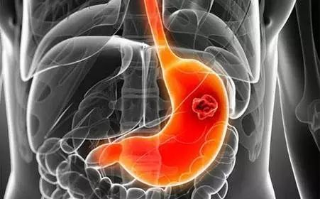 痔疮病补硒有没有效果(痔疮要补充哪种维生素)-硒宝网